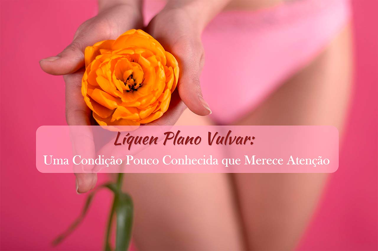Líquen Plano Vulvar: Uma Condição Pouco Conhecida que Merece Atenção
