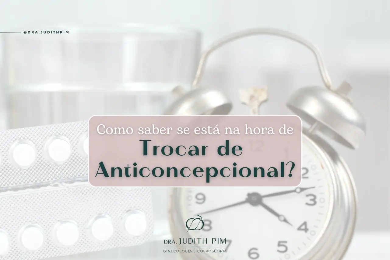 Como saber se está na hora de trocar de Anticoncepcional