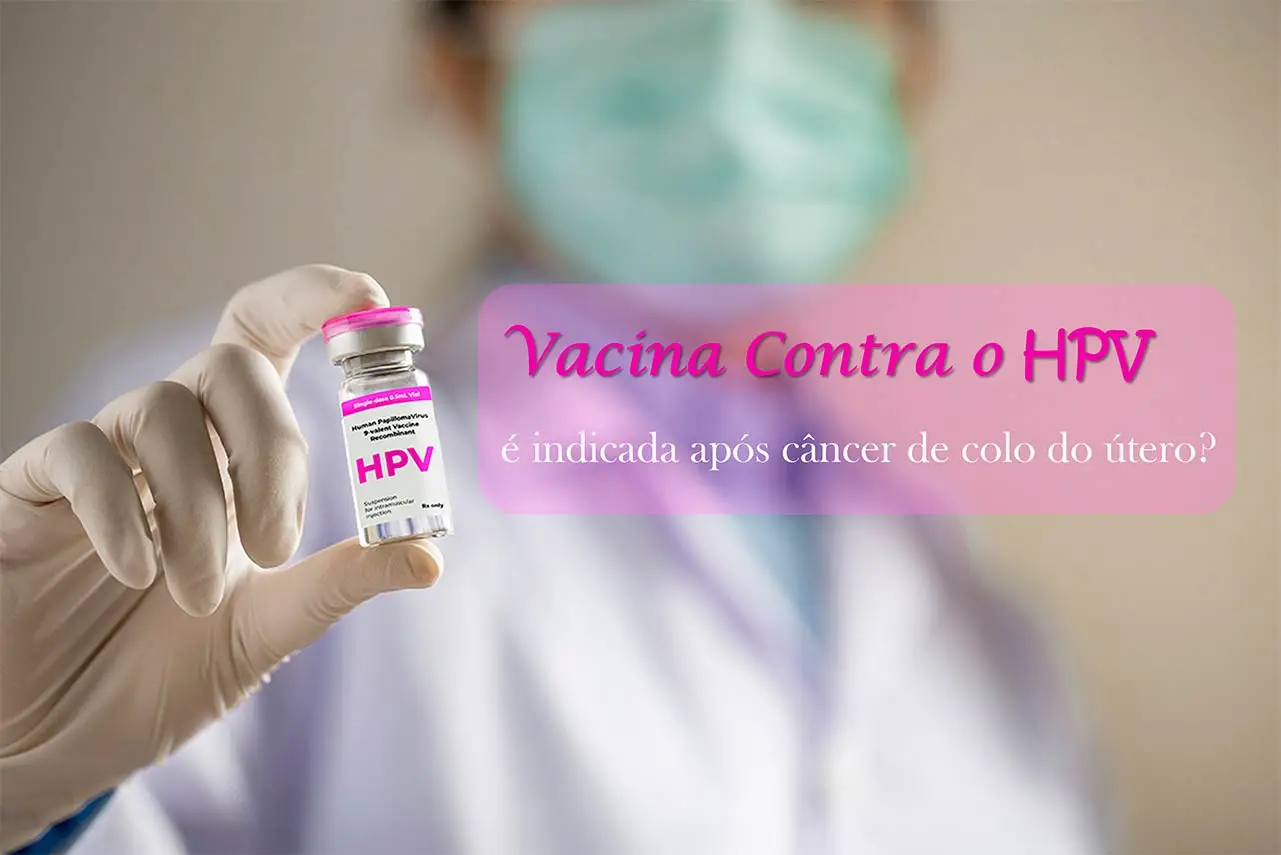 Vacina contra o HPV ap&oacute;s o c&acirc;ncer do colo do &uacute;tero: posso tomar?